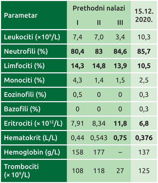 Tabela1