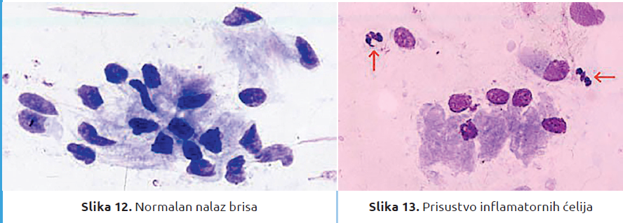 Slika4