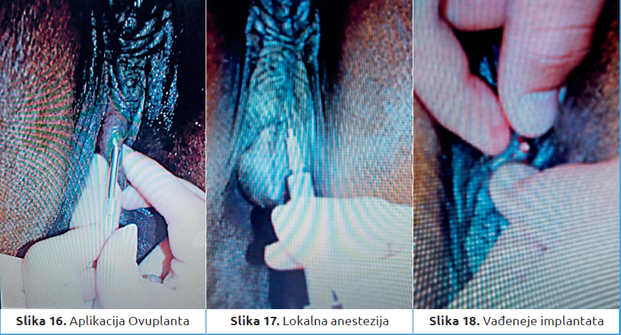 Slika6